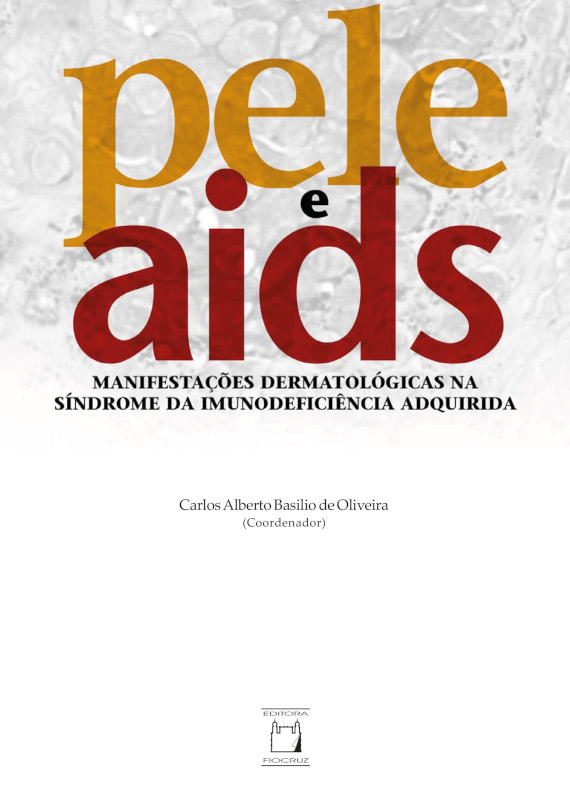 Pele e Aids: manifestações dermatológicas na síndrome da...